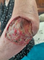 1st elbow.jpg